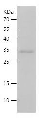 Recombinant Mouse IL-15