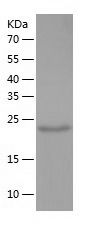    ALDH3B2 / Recombinant Human ALDH3B2