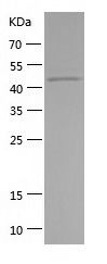    SerpinB4 / Recombinant Human SerpinB4