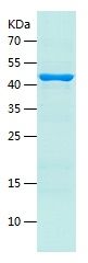    STCH / Recombinant Human STCH