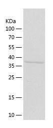    AMT / Recombinant Human AMT