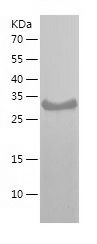    CCN3 / Recombinant Human CCN3