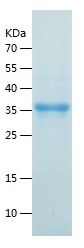    RPIA / Recombinant Human RPIA