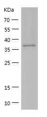    DHPS / Recombinant Human DHPS