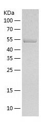    Seryl-tRNA synthetase / Recombinant Human Seryl-tRNA synthetase