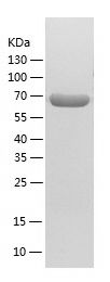    ACADVL / Recombinant Human ACADVL