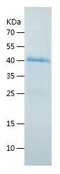    SEPP1 / Recombinant Human SEPP1