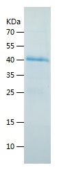    SEPP1 / Recombinant Human SEPP1