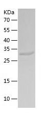    ketohexokinase / Recombinant Human ketohexokinase