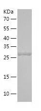    SULT1A2 / Recombinant Human SULT1A2