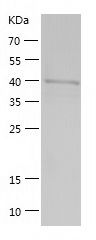 Recombinant Mouse SAHH