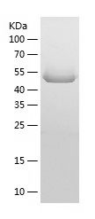    MMP14 / Recombinant Human MMP14