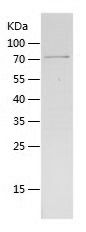    GDI2 / Recombinant Human GDI2