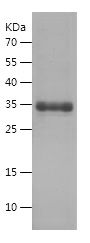    CPT1A / Recombinant Human CPT1A
