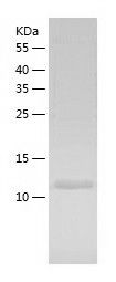    NUDT2 / Recombinant Human NUDT2