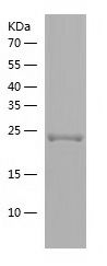   RAB5C / Recombinant Human RAB5C