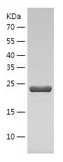    RAB7 / Recombinant Human RAB7