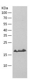    DUSP3 / Recombinant Human DUSP3