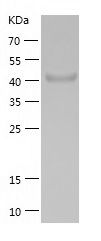    GALK1 / Recombinant Human GALK1