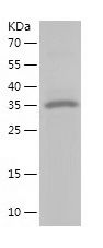    Calponin 1 / Recombinant Human Calponin 1