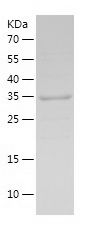    MNAT1 / Recombinant Human MNAT1