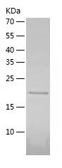    UBCH6 / Recombinant Human UBCH6