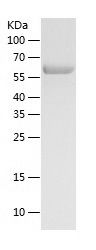    KPNA2 / Recombinant Human KPNA2