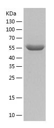 Recombinant Mouse PKM2