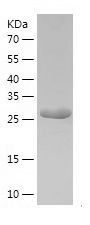    ATP citrate lyase / Recombinant Human ATP citrate lyase