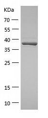    Methionyl Aminopeptidase 1 / Recombinant Human Methionyl Aminopeptidase 1