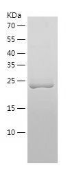    CRYBA4 / Recombinant Human CRYBA4