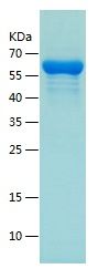    Tyrosyl tRNA synthetase / Recombinant Human Tyrosyl tRNA synthetase