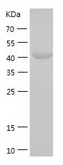    hHR23b / Recombinant Human hHR23b