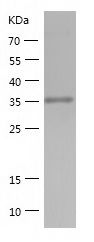    ADPRH / Recombinant Human ADPRH