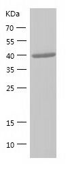    Proteasome 19S S5A / Recombinant Human Proteasome 19S S5A