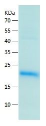    ARMET / Recombinant Human ARMET