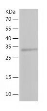 Recombinant Mouse LRPAP1