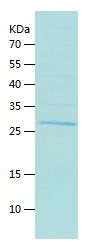    Neurotrypsin / Recombinant Human Neurotrypsin