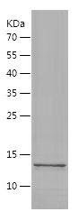    EG-VEGF / Recombinant Human EG-VEGF