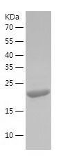    Rab15 / Recombinant Human Rab15