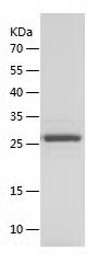    Triosephosphate isomerase / Recombinant Human Triosephosphate isomerase