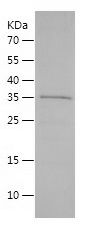    Myelin PLP / Recombinant Human Myelin PLP