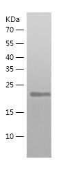    SNAP25 / Recombinant Human SNAP25