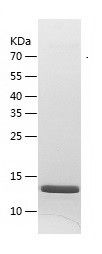    Ube2N / Recombinant Human Ube2N