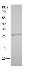    PSME3 / Recombinant Human PSME3