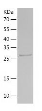    PSME3 / Recombinant Human PSME3