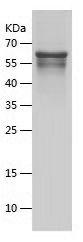    Islet 1 / Recombinant Human Islet 1