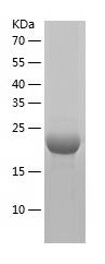    NCALD / Recombinant Human NCALD