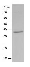    WDR68 / Recombinant Human WDR68