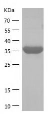    USP46 / Recombinant Human USP46